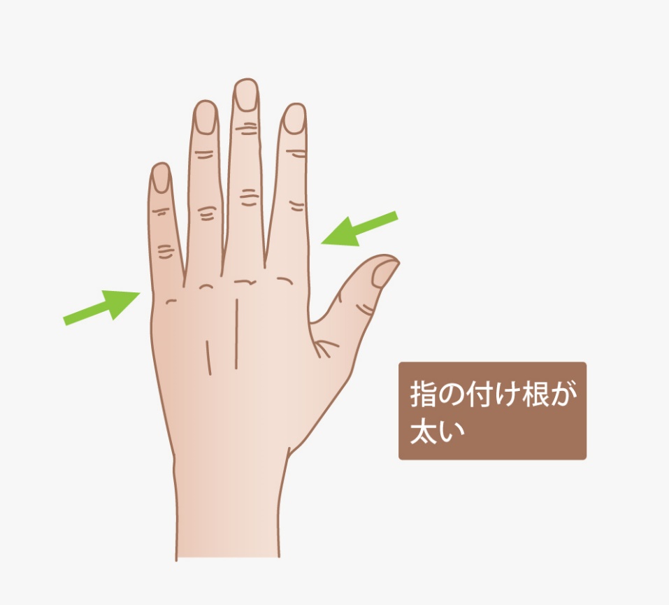 指の付け根が太いタイプの例