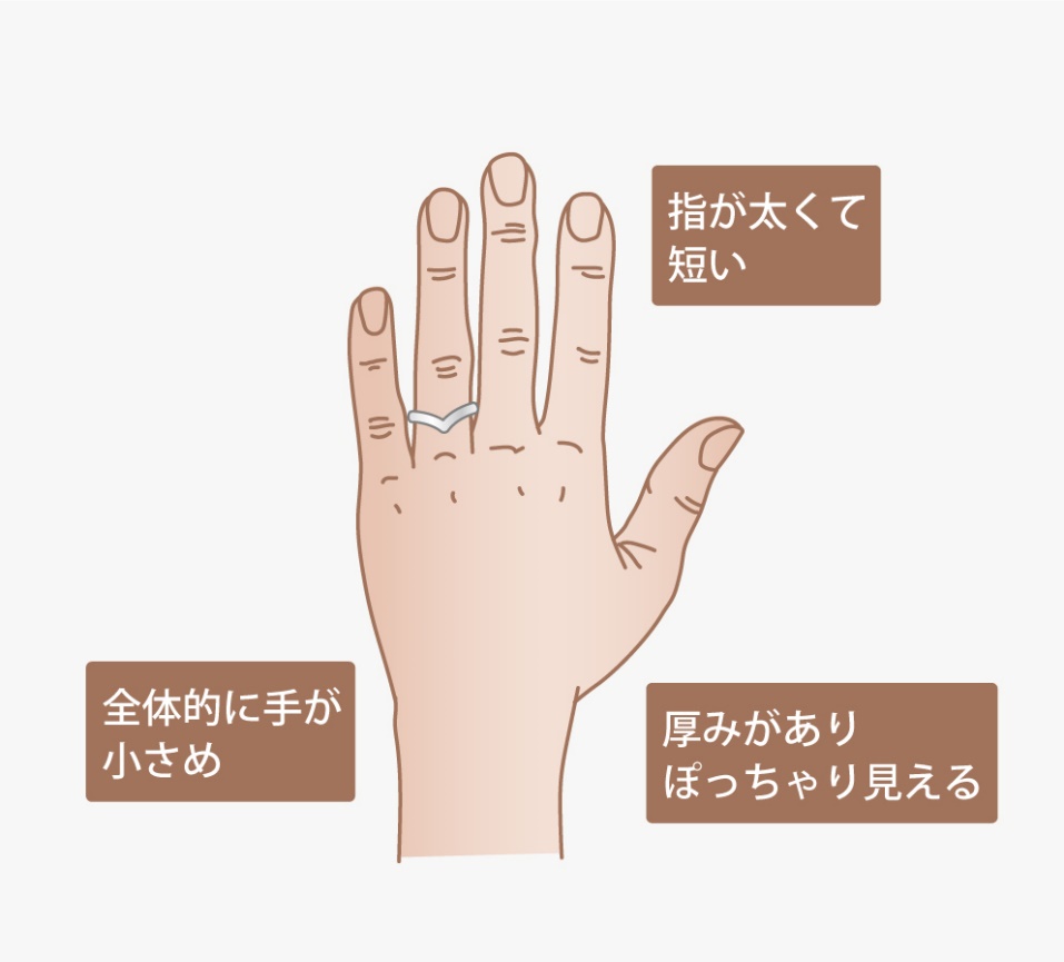 手が小さく、指が太くて短い。厚みがありぽっちゃり見えるタイプの例